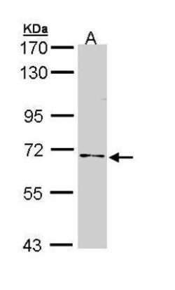 Invitrogen NUMB Polyclonal Antibody 100 &mu;L | Buy Online | Invitrogen&trade; | Fisher Scientific