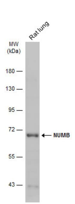 Invitrogen NUMB Polyclonal Antibody 100 &mu;L | Buy Online | Invitrogen&trade; | Fisher Scientific