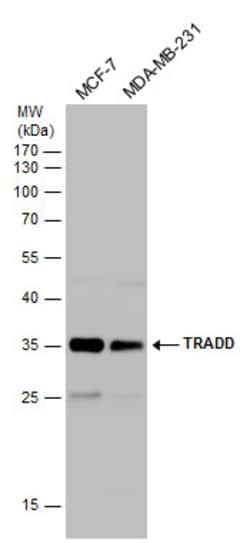 Invitrogen TRADD Polyclonal Antibody 100 &mu;L | Buy Online | Invitrogen&trade; | Fisher Scientific