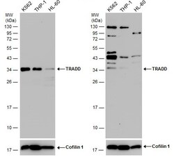 Invitrogen TRADD Polyclonal Antibody 100 &mu;L | Buy Online | Invitrogen&trade; | Fisher Scientific