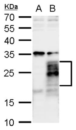 Invitrogen FGF18 Polyclonal Antibody 100 &mu;L; Unconjugated:Antibodies,