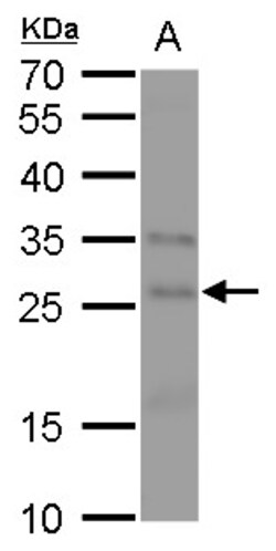 Invitrogen FGF18 Polyclonal Antibody 100 &mu;L; Unconjugated:Antibodies,