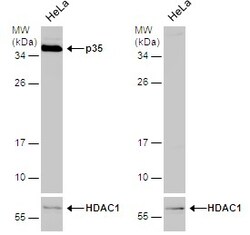 Invitrogen p35 Polyclonal Antibody 100 &mu;L; Unconjugated:Antibodies,
