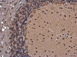 Invitrogen p35 Polyclonal Antibody 100 &mu;L; Unconjugated:Antibodies,