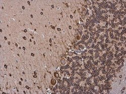 Invitrogen p35 Polyclonal Antibody 100 &mu;L; Unconjugated:Antibodies,