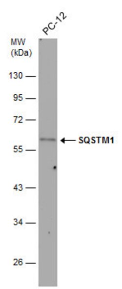 Invitrogen SQSTM1 Polyclonal Antibody 100 &mu;L; Unconjugated:Antibodies,
