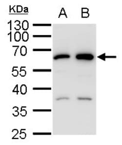 Invitrogen SQSTM1 Polyclonal Antibody 100 &mu;L; Unconjugated:Antibodies,