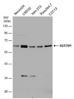 Invitrogen SQSTM1 Polyclonal Antibody 100 &mu;L; Unconjugated:Antibodies,