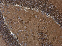 Invitrogen WAVE1 Polyclonal Antibody 100 &mu;L; Unconjugated:Antibodies,