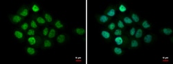 Invitrogen MTA1 Polyclonal Antibody 100 &mu;L; Unconjugated:Antibodies,