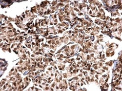 Invitrogen MTA1 Polyclonal Antibody 100 &mu;L; Unconjugated:Antibodies,