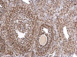 Invitrogen MTA1 Polyclonal Antibody 100 &mu;L; Unconjugated:Antibodies,