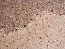 Invitrogen MTA1 Polyclonal Antibody 100 &mu;L; Unconjugated:Antibodies,