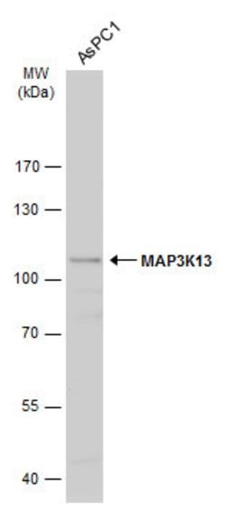 Invitrogen LZK Polyclonal Antibody 100 &mu;L | Buy Online | Invitrogen&trade; | Fisher Scientific