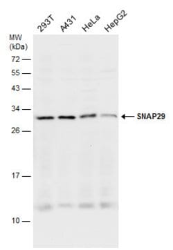 Invitrogen SNAP29 Polyclonal Antibody 100 &mu;L | Buy Online | Invitrogen&trade; | Fisher Scientific
