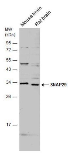 Invitrogen SNAP29 Polyclonal Antibody 100 &mu;L | Buy Online | Invitrogen&trade; | Fisher Scientific