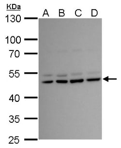 Invitrogen LHX2 Polyclonal Antibody 100 &mu;L; Unconjugated:Antibodies,