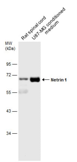 Invitrogen NTN1 Polyclonal Antibody 100 &mu;L; Unconjugated:Antibodies,