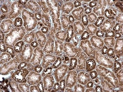Invitrogen ROCK2 Polyclonal Antibody 100 &mu;L; Unconjugated:Antibodies,