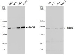 Invitrogen ROCK2 Polyclonal Antibody 100 &mu;L; Unconjugated:Antibodies,