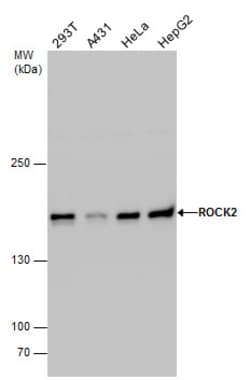 Invitrogen ROCK2 Polyclonal Antibody 100 &mu;L; Unconjugated:Antibodies,