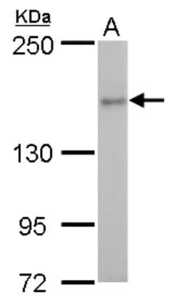 Invitrogen ROCK2 Polyclonal Antibody 100 &mu;L; Unconjugated:Antibodies,