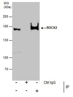 Invitrogen ROCK2 Polyclonal Antibody 100 &mu;L | Buy Online | Invitrogen&trade; | Fisher Scientific