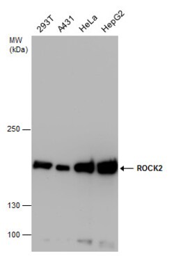 Invitrogen ROCK2 Polyclonal Antibody 100 &mu;L | Buy Online | Invitrogen&trade; | Fisher Scientific