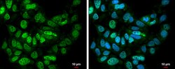 Invitrogen BCLAF1 Polyclonal Antibody 100 &mu;L; Unconjugated:Antibodies,