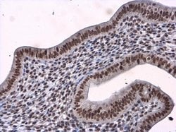 Invitrogen BCLAF1 Polyclonal Antibody 100 &mu;L; Unconjugated:Antibodies,