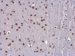 Invitrogen BCLAF1 Polyclonal Antibody 100 &mu;L; Unconjugated:Antibodies,