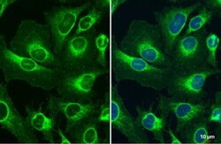 Invitrogen TOMM20 Polyclonal Antibody 100 &mu;L; Unconjugated:Antibodies,