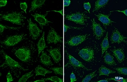 Invitrogen TOMM20 Polyclonal Antibody 100 &mu;L; Unconjugated:Antibodies,