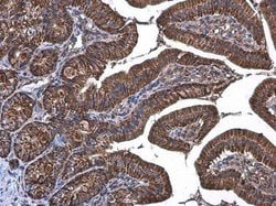 Invitrogen TOMM20 Polyclonal Antibody 100 &mu;L; Unconjugated:Antibodies,
