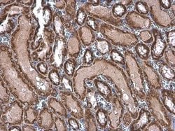 Invitrogen TOMM20 Polyclonal Antibody 100 &mu;L; Unconjugated:Antibodies,