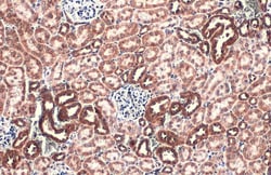 Invitrogen TOMM20 Polyclonal Antibody 100 &mu;L; Unconjugated:Antibodies,