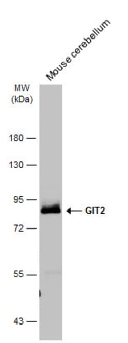 Invitrogen GIT2 Polyclonal Antibody 100 &mu;L | Buy Online | Invitrogen&trade; | Fisher Scientific