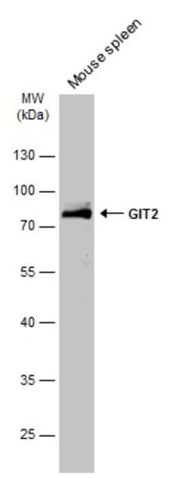 Invitrogen GIT2 Polyclonal Antibody 100 &mu;L | Buy Online | Invitrogen&trade; | Fisher Scientific