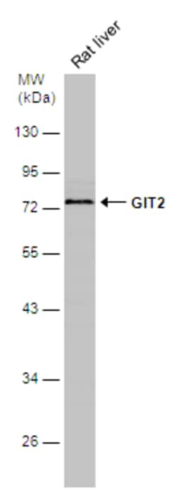 Invitrogen GIT2 Polyclonal Antibody 100 &mu;L | Buy Online | Invitrogen&trade; | Fisher Scientific