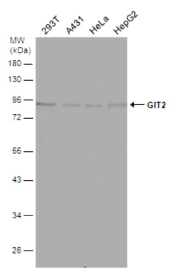 Invitrogen GIT2 Polyclonal Antibody 100 &mu;L | Buy Online | Invitrogen&trade; | Fisher Scientific