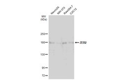 Invitrogen ZEB2 Polyclonal Antibody 100 &mu;L; Unconjugated:Antibodies,