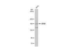 Invitrogen ZEB2 Polyclonal Antibody 100 &mu;L; Unconjugated:Antibodies,