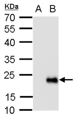 Invitrogen RGS19 Polyclonal Antibody 100 &mu;L; Unconjugated:Antibodies,