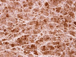 Invitrogen PRMT5 Polyclonal Antibody 100 &mu;L; Unconjugated:Antibodies,