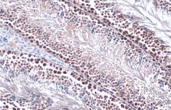 Invitrogen PRMT5 Polyclonal Antibody 100 &mu;L; Unconjugated:Antibodies,
