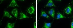 Invitrogen ACAA2 Polyclonal Antibody 100 &mu;L; Unconjugated:Antibodies,