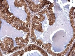Invitrogen ACAA2 Polyclonal Antibody 100 &mu;L; Unconjugated:Antibodies,