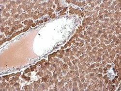 Invitrogen ACAA2 Polyclonal Antibody 100 &mu;L; Unconjugated:Antibodies,