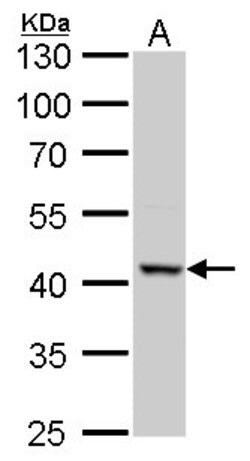 Invitrogen ACAA2 Polyclonal Antibody 100 &mu;L; Unconjugated:Antibodies,
