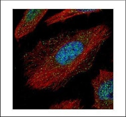 Invitrogen TAB1 Polyclonal Antibody 100 &mu;L | Buy Online | Invitrogen&trade; | Fisher Scientific